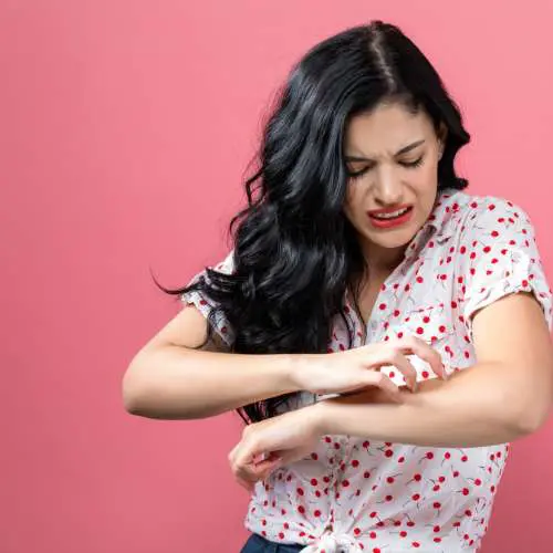 girl suffer hitchy skin due to chlorine and hard water