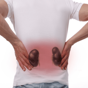 Image of Kidney problems from 1,4 dioxane